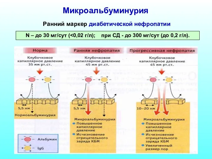 Микроальбуминурия Ранний маркер диабетической нефропатии N – до 30 мг/сут (