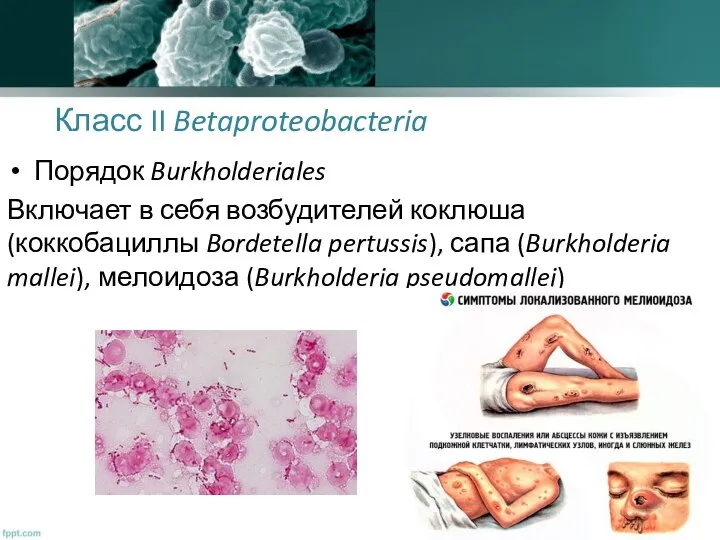 Класс II Betaproteobacteria Порядок Burkholderiales Включает в себя возбудителей коклюша (коккобациллы