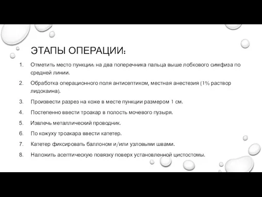 ЭТАПЫ ОПЕРАЦИИ: Отметить место пункции: на два поперечника пальца выше лобкового