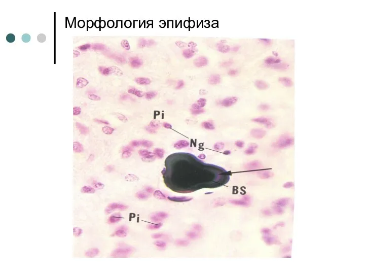 Морфология эпифиза