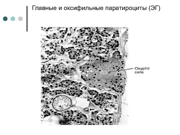 Главные и оксифильные паратироциты (ЭГ)