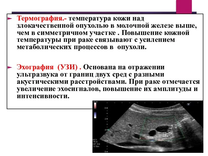 Термография.- температура кожи над злокачественной опухолью в молочной железе выше, чем