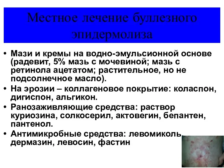 Местное лечение буллезного эпидермолиза Мази и кремы на водно-эмульсионной основе (радевит,