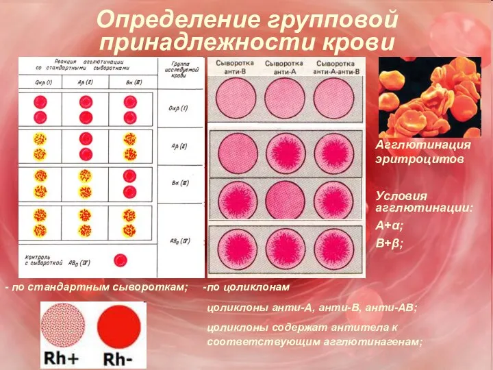 Определение групповой принадлежности крови - по стандартным сывороткам; по цоликлонам цоликлоны