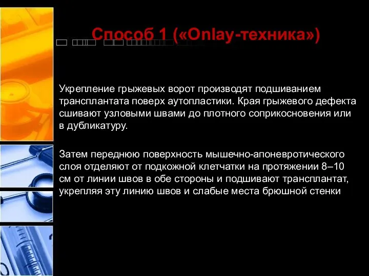 Способ 1 («Onlay-техника») Укрепление грыжевых ворот производят подшиванием трансплантата поверх аутопластики.