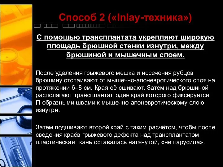 Способ 2 («Inlay-техника») С помощью трансплантата укрепляют широкую площадь брюшной стенки