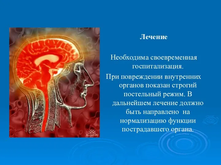 Лечение Необходима своевременная госпитализация. При повреждении внутренних органов показан строгий постельный