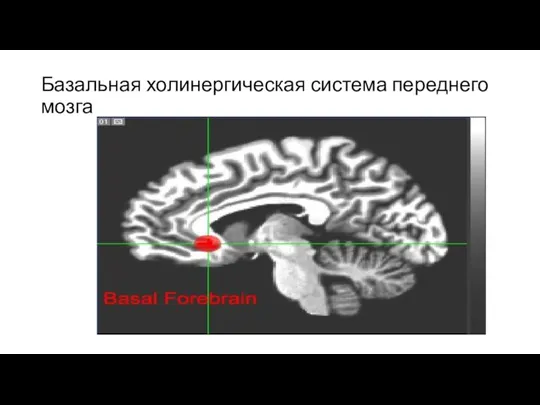 Базальная холинергическая система переднего мозга