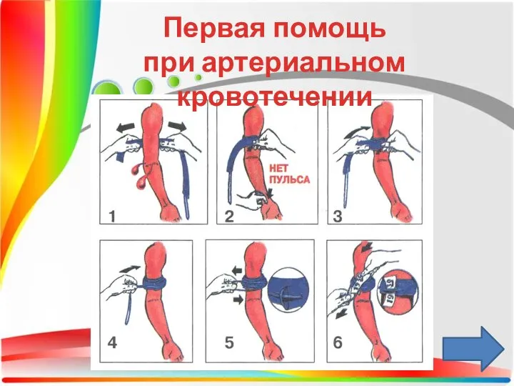 Первая помощь при артериальном кровотечении