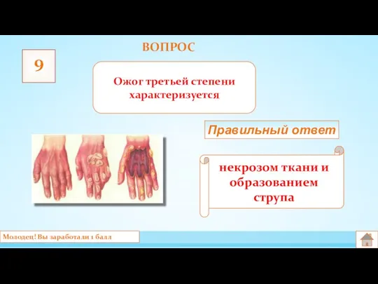 ВОПРОС 9 Ожог третьей степени характеризуется некрозом ткани и образованием струпа