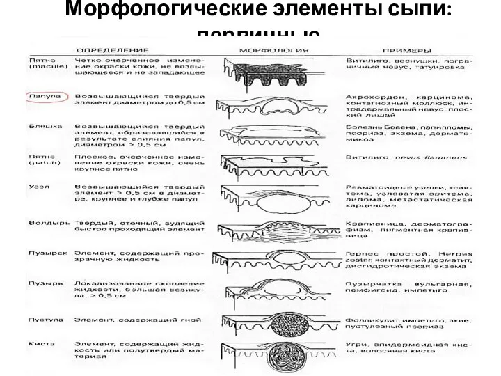 Морфологические элементы сыпи: первичные