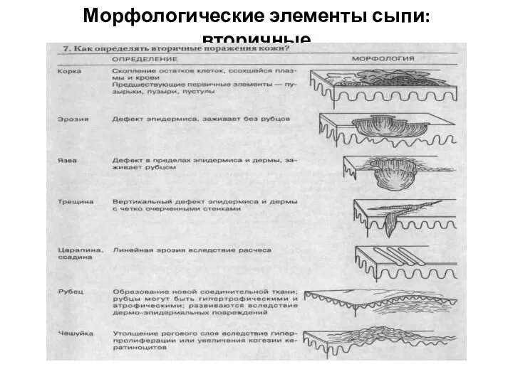 Морфологические элементы сыпи: вторичные