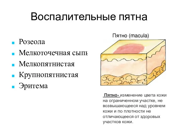 Воспалительные пятна Розеола Мелкоточечная сыпь Мелкопятнистая Крупнопятнистая Эритема Пятно- изменение цвета