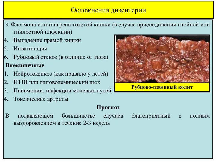 Осложнения дизентерии 3. Флегмона или гангрена толстой кишки (в случае присоединения