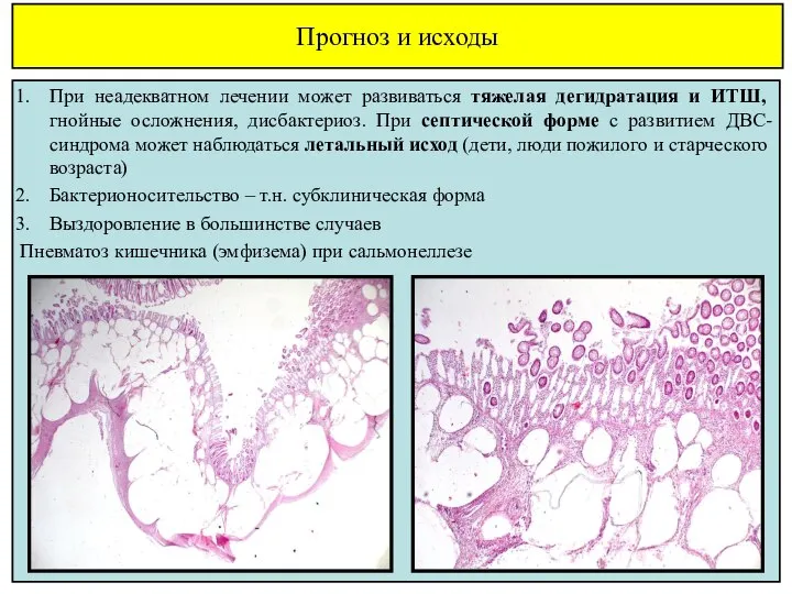 Прогноз и исходы При неадекватном лечении может развиваться тяжелая дегидратация и