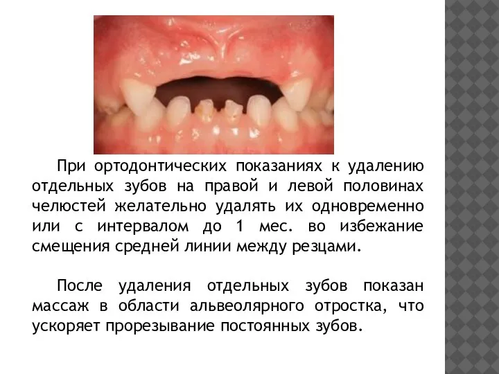 При ортодонтических показаниях к удалению отдельных зубов на правой и левой
