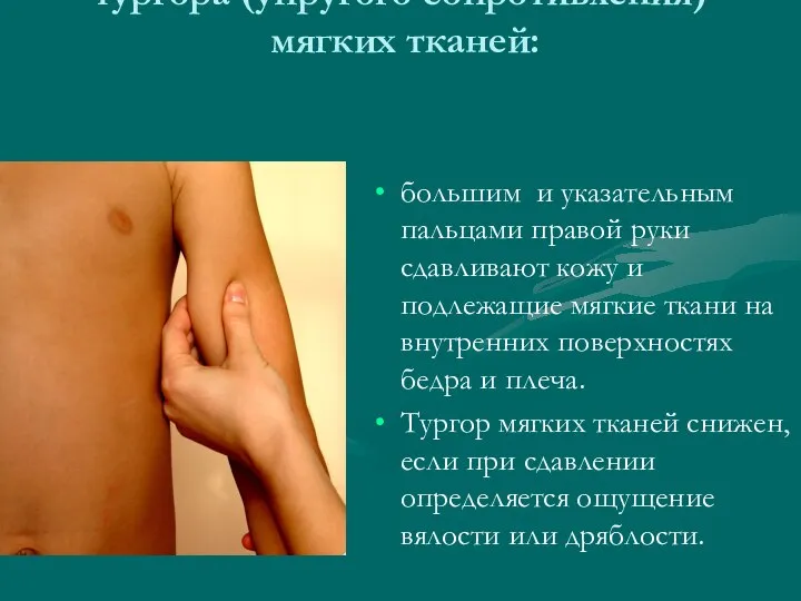Определение состояния тургора (упругого сопротивления) мягких тканей: большим и указательным пальцами