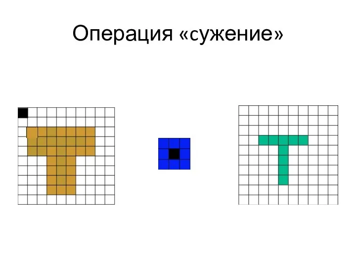 Операция «cужение»