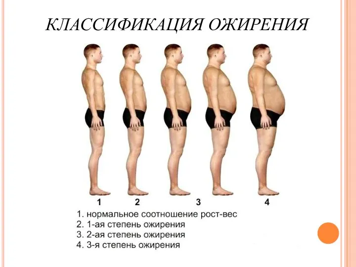 КЛАССИФИКАЦИЯ ОЖИРЕНИЯ