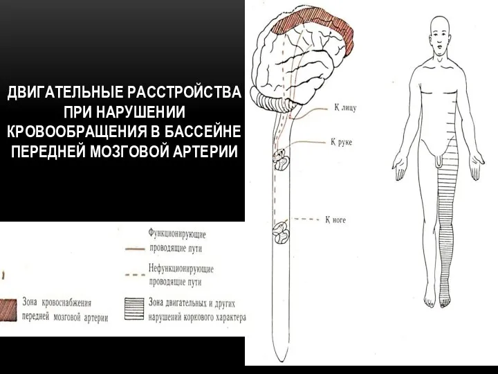 ДВИГАТЕЛЬНЫЕ РАССТРОЙСТВА ПРИ НАРУШЕНИИ КРОВООБРАЩЕНИЯ В БАССЕЙНЕ ПЕРЕДНЕЙ МОЗГОВОЙ АРТЕРИИ