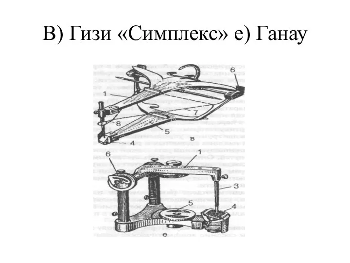 В) Гизи «Симплекс» е) Ганау