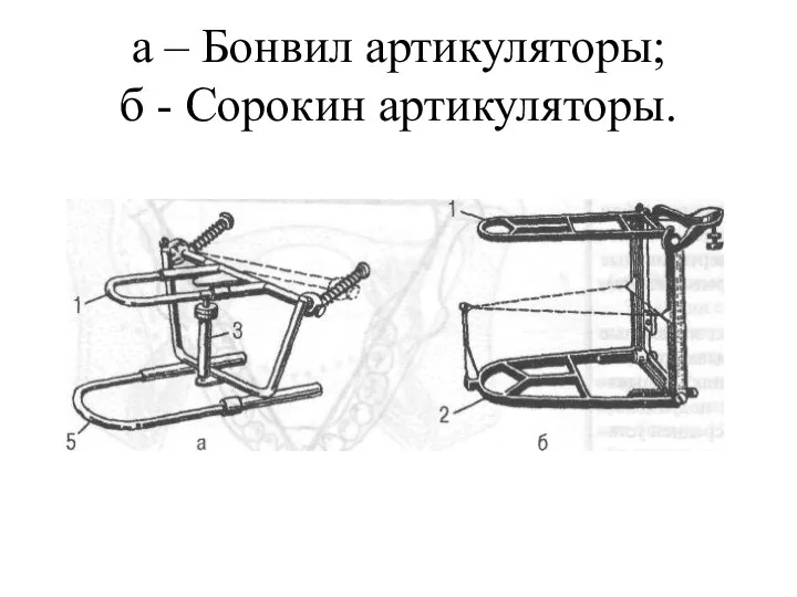 а – Бонвил артикуляторы; б - Сорокин артикуляторы.