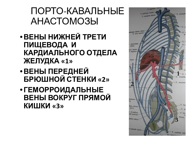 ПОРТО-КАВАЛЬНЫЕ АНАСТОМОЗЫ ВЕНЫ НИЖНЕЙ ТРЕТИ ПИЩЕВОДА И КАРДИАЛЬНОГО ОТДЕЛА ЖЕЛУДКА «1»