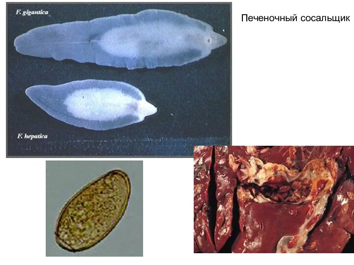 Печеночный сосальщик
