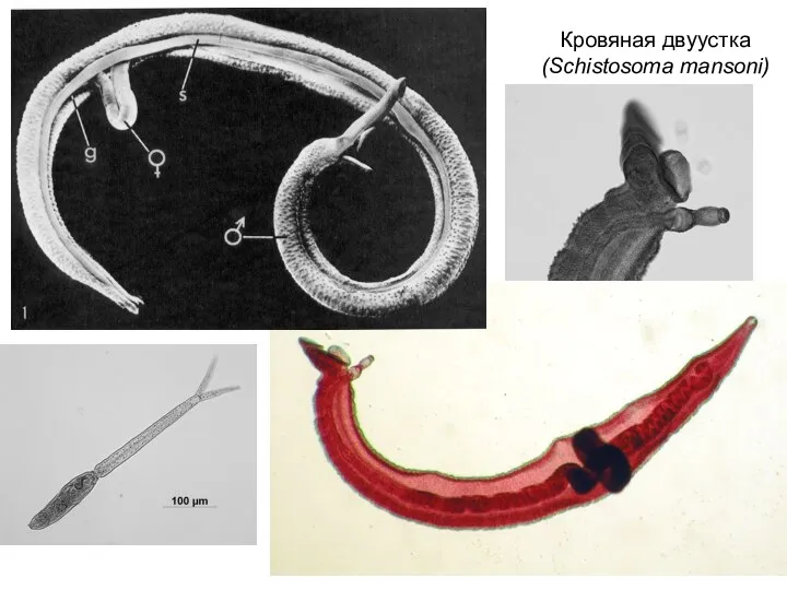 Кровяная двуустка (Schistosoma mansoni)