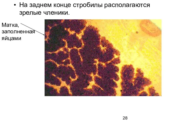 На заднем конце стробилы располагаются зрелые членики. Матка, заполненная яйцами