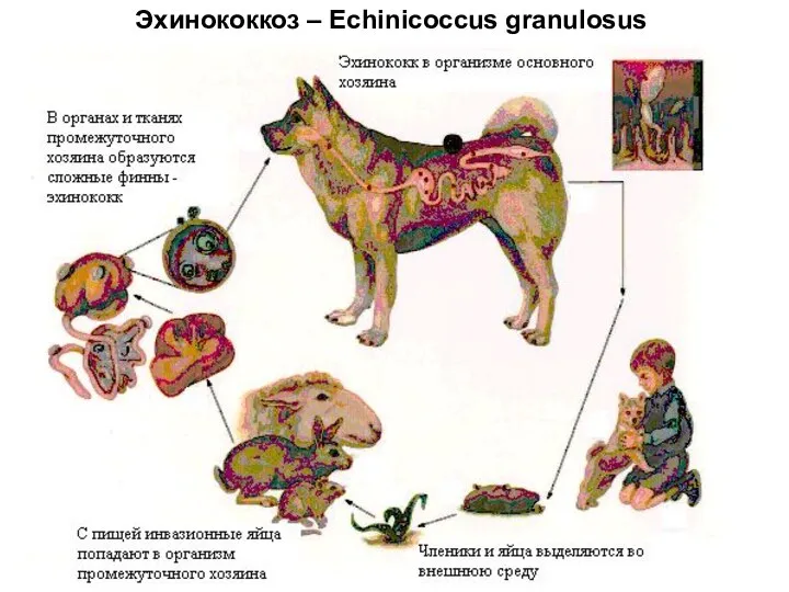 Эхинококкоз – Echinicoccus granulosus