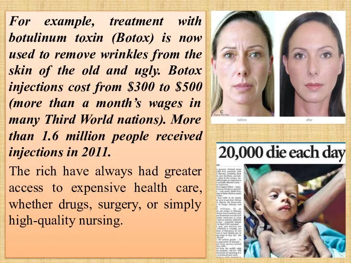 For example, treatment with botulinum toxin (Botox) is now used to