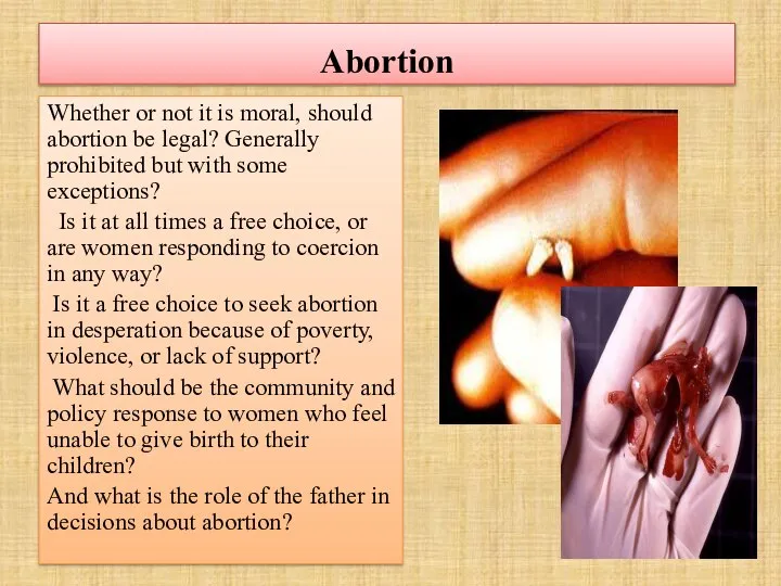 Abortion Whether or not it is moral, should abortion be legal?