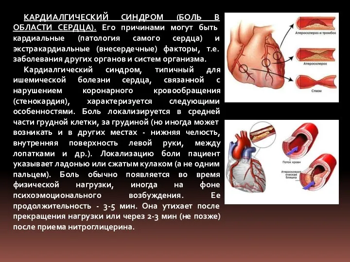 КАРДИАЛГИЧЕСКИЙ СИНДРОМ (БОЛЬ В ОБЛАСТИ СЕРДЦА). Его причинами могут быть кардиальные