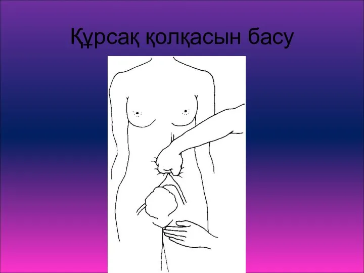 Құрсақ қолқасын басу