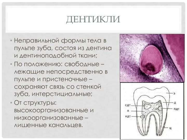 ДЕНТИКЛИ Неправильной формы тела в пульпе зуба, состоя из дентина и