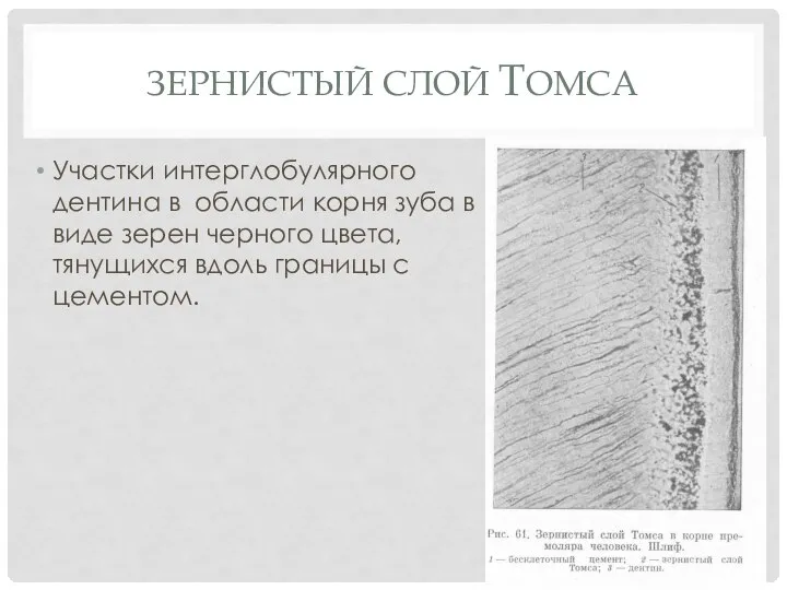 ЗЕРНИСТЫЙ СЛОЙ ТОМСА Участки интерглобулярного дентина в области корня зуба в