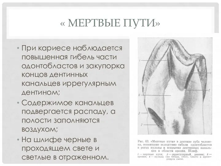 « МЕРТВЫЕ ПУТИ» При кариесе наблюдается повышенная гибель части одонтобластов и