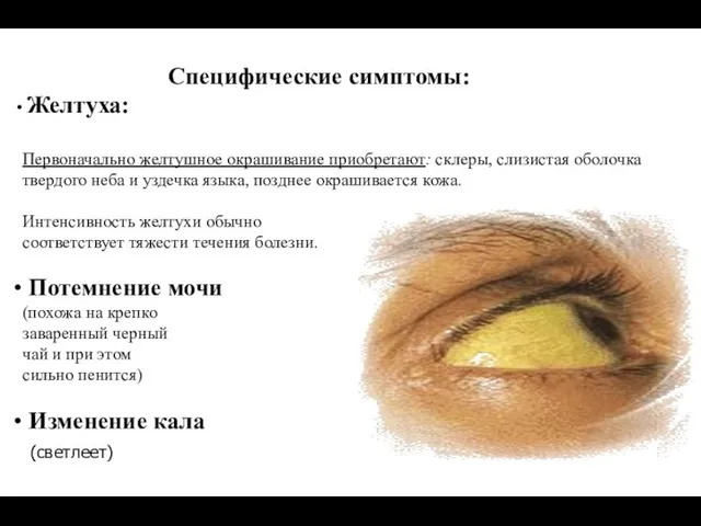 Специфические симптомы: Желтуха: Первоначально желтушное окрашивание приобретают: склеры, слизистая оболочка твердого