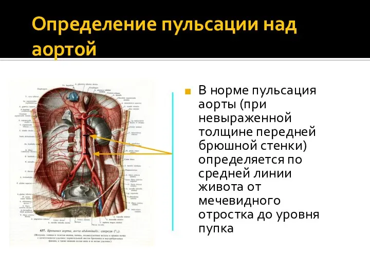 Определение пульсации над аортой В норме пульсация аорты (при невыраженной толщине