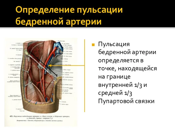 Определение пульсации бедренной артерии Пульсация бедренной артерии определяется в точке, находящейся