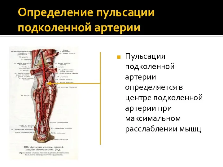 Определение пульсации подколенной артерии Пульсация подколенной артерии определяется в центре подколенной артерии при максимальном расслаблении мышц