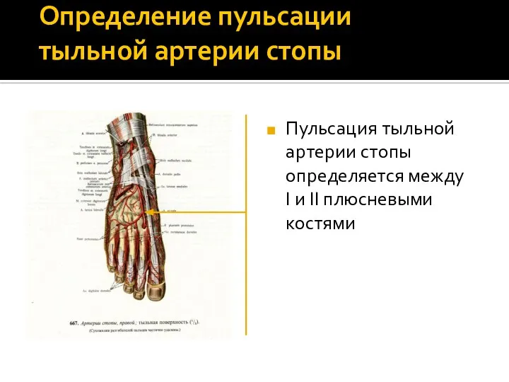 Определение пульсации тыльной артерии стопы Пульсация тыльной артерии стопы определяется между I и II плюсневыми костями