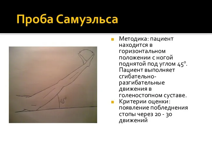 Проба Самуэльса Методика: пациент находится в горизонтальном положении с ногой поднятой