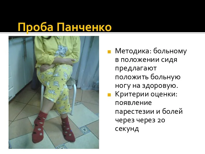 Проба Панченко Методика: больному в положении сидя предлагают положить больную ногу