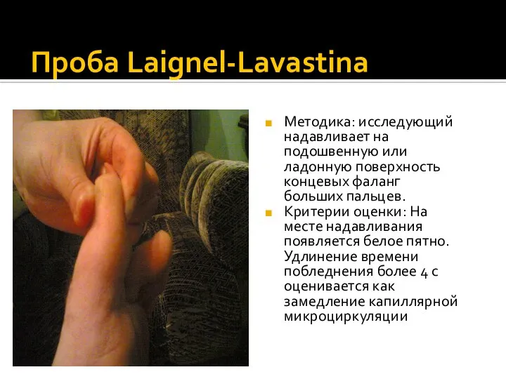 Проба Laignel-Lavastina Методика: исследующий надавливает на подошвенную или ладонную поверхность концевых