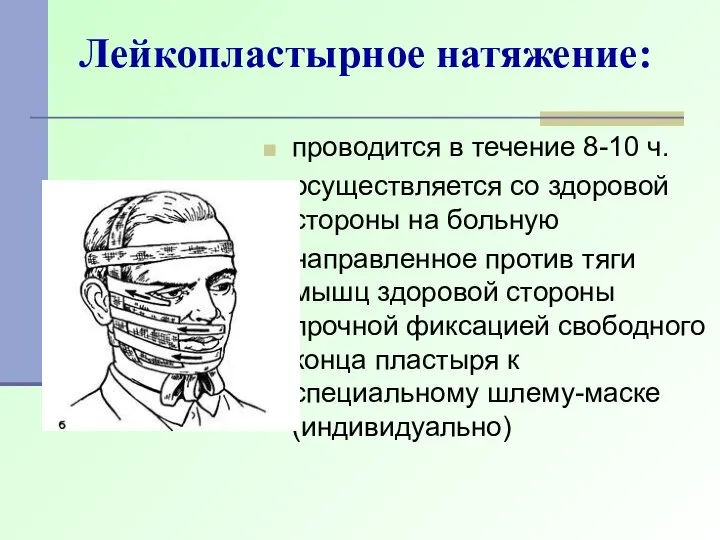 Лейкопластырное натяжение: проводится в течение 8-10 ч. осуществляется со здоровой стороны