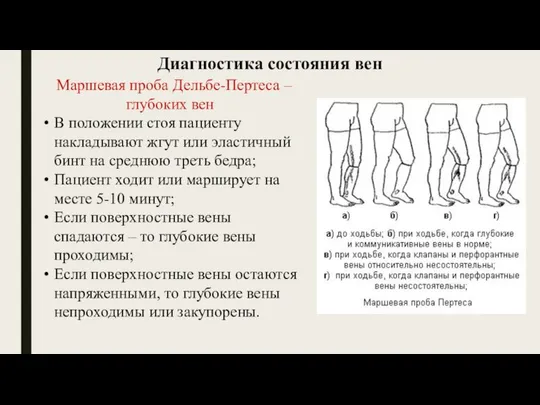 Диагностика состояния вен Маршевая проба Дельбе-Пертеса – глубоких вен В положении