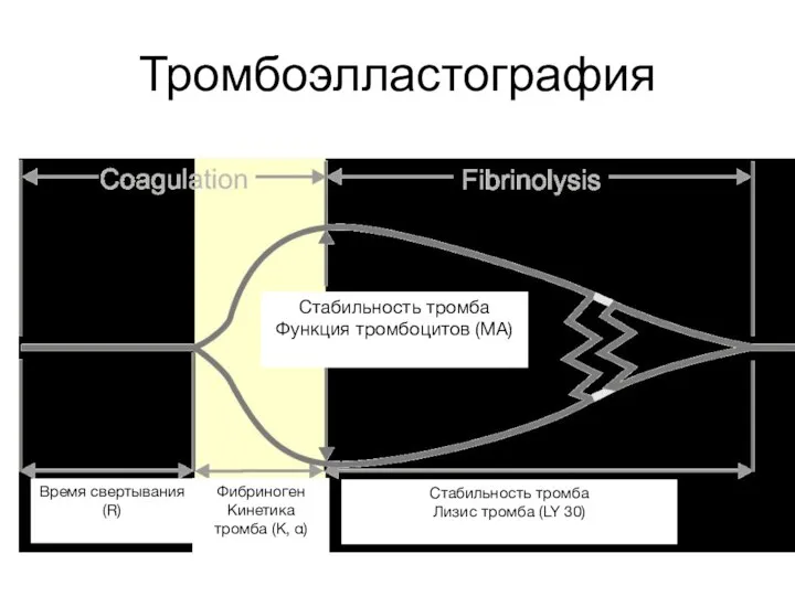 Тромбоэлластография Фибриноген Кинетика тромба (К, α) Стабильность тромба Лизис тромба (LY