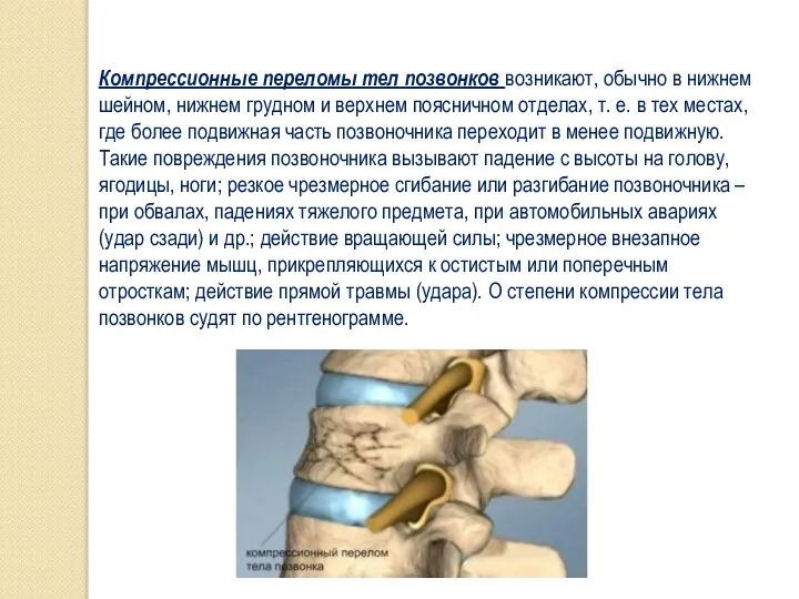 Компрессионные переломы тел позвонков возникают, обычно в нижнем шейном, нижнем грудном